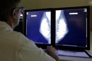 Los hombres son más propensos a morir de cáncer, según un estudio