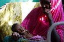 Una mujer somalí carga a su hijo mientras es atendido por un alto grado de desnutrición en un hospital. EFE/Archivo