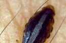 Hembra del piojo chupador de la especie "Pediculus humanus corporis" sobre la piel de una persona tras haberse alimentado de su sangre. EFE/Archivo