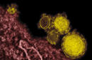ARCHIVO - Esta imagen de microscopio proveída por el Instituto Nacional de Alergias y Enfermedades Infecciosas de Estados Unidos muestra partículas del nuevo coronavirus, conocido tambien como MERS, colorizadas en amarillo. (Foto AP/NIAID - RML)