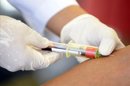 Una enfermera realiza una prueba gratuita de detección del Virus de Inmunodeficiencia Humana (VIH) en San Salvador (El Salvador). EFE/Archivo
