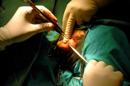 La fisura de labio y paladar -conocida como labio leporino- es una malformación maxilofacial que se presenta en personas que nacen con una falta de tejidos, fundamentalmente óseos. EFE/Archivo