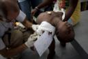 Un niño con síntomas de cólera es atendido en el hospital Santa Catherine, ubicado en el distrito de Cite Soleil en Puerto Príncipe (Haití). EFE/Archivo