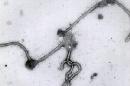 Fotografía sin fecha difundida por el Instituto Antwerp de Medicina Tropical en Amberes, Bélgica, en la que aparece el virus del ébola a través de un microscopio electrónico. Hasta 2014, ha habido dos decenas de brotes de ébola en África desde que el virus apareció por primera vez en 1976. (Foto AP/Instituto Antwerp de Medicina Tropical)