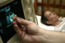 El aborto está penalizado en Bolivia salvo en caso de embarazos producto de violación, rapto no seguido de matrimonio, estupro, incesto y cuando la vida de la madre esté en riesgo. EFE/Archivo