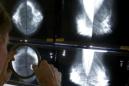 ARCHIVO - En esta imagen de archivo del 6 de mayo de 2010, un radiólogo uitliza una lupa para buscar cáncer de mama en mamografías en Los Ángeles. Estas pruebas diagnósticas son especialmente beneficiosas a partir de los 50 años, según dijo un equipo de trabajo del gobierno estadounidense. (AP Foto/Damian Dovarganes, Archivo)
