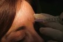 Descubierto en Estados Unidos un medicamento antiarrugas Botox falsificado