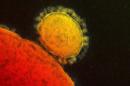 Esta imagen suministrada por el Instituto Nacional de Alergia y Enfermedades Infeccionsas muestras la transmisión (coloreada) del virus MERS que surgió en el 2012. El viernes 2 de mayo del 2014, las autoridades de salud dijeron que se presentó por primera vez un paciente de MERS en Estados Unidos después de llegar al país procedente de Arabia Saudí. (AP Foto/National Institute for Allergy and Infectious Diseases via The Canadian Press, Archivo)