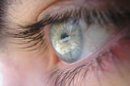 El glaucoma, segunda causa de ceguera en el mundo, no se puede prevenir pero sí tratar