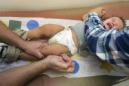 El pediatra Charles Goodman aplica a Cameron Fierro, de un año de edad, la vacuna contra sarampión-rubiola-paperas, en un hospital de Northridge, California, el 25 de enero de 2015. La Asamblea del estado aprobó el martes 30 de junio de 2015 una polémica ley que obliga a casi todos los niños en edad escolar a ser vacunados. (Foto AP/Damian Dovarganes, Archivo)