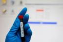 Un análisis de sangre podría permitir tratamientos personalizados de la depresión