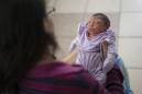 Cassiana Severino sostiene a su hija Melisa Vitoria, nacida con microcefalia en el hospital IMIP en Recife, Brasil, el miércoles 3 de febrero de 2016. El virus Zika es propagado por el mosquito Aedes aegypti, el cual está muy adaptado a los humanos, prolifera en casas de la gente y puede reproducirse en poca agua estancada, como la que cabe en un tapón de botella. Se sospecha que el virus Zika ocasiona microcefalia durante la gestación. (Foto AP/Felipe Dana)