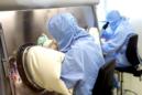 El siguiente paso después de este estudio será probar medicamentos para descubrir si pueden frenar o revertir la fibrosis en los ratones. EFE/Archivo