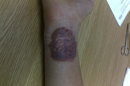 Tatuajes de henna, una ‘ruleta rusa’ para la piel