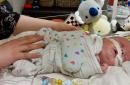 Caylyn Otto toca a su hijo, Oliver, en el hospital infantil de Phoenix en Phoenix, Arizona, el 13 de febrero de 2015. (Foto AP/Terry Tang)