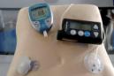 Un sistema de transmisión inalámbrica de los valores de glucosa. EFE/Archivo