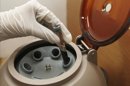 Una muestra de sangre es analizada en un kit que identifica el virus VIH. EFE/Archivo