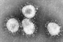 Muestra del Coronavirus en un microscopio. EFE/Archivo