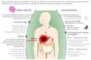 Detalle de la infografía de la Agencia EFE "El plan de la hepatitis C" disponible en http://infografias.efe.com. EFE/Archivo