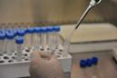 Más de 240 millones de personas conviven con el virus de la hepatitis B y dos terceras partes de ellos nunca han sido diagnosticados, por lo que corren el peligro de desarrollar cirrosis o cáncer de hígado, según la Organización Mundial de la Salud (OMS). EFE/Archivo
