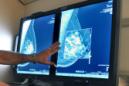 ARCHIVO - En esta foto de archivo del 31 de julio de 2012, un radiólogo compara una imagen de una mamografía bidimensional con otra posterior en 3D. Las probabilidades de morir de cáncer de seno muy precoz son escasas, pero los riesgos son mayores para las mujeres jóvenes y negras, las mismas disparidades que se advierten en el cáncer más avanzado, de acuerdo con investigaciones recientes. (Torin Halsey/Times Record News via AP)