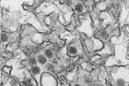 Esta imagen microscópica de enero del 2016 provista por los Centros para el Control y Prevencion de Enfermedad muestra el virus del zika. El viernes 15 de julio del 2016, los CDC dijeron que una mujer de la ciudad de Nueva York infectó a su pareja mas culina con el virus del zika a través de relaciones sexuales, la primera vez que se documenta una transmisión del germen de una mujer a un hombre. (Cynthia Goldsmith/CDC via AP)