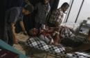 Un hombre recibe tratamiento médico tras ser herido en un bombardeo por fuerzas leales al régimen en el hospital de Douma, a las afuera de Damasco, Siria hoy 9 de septiembre de 2016. EFE