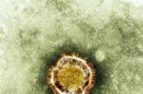 Confirmado el segundo caso de coronavirus en Francia