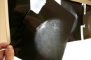 Fotografía de una prueba radiológica de mama. EFE/Archivo