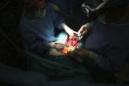 Fotografía de un equipo médico que realiza una intervención. EFE/Archivo